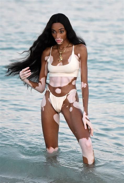 #winnieharlow international model, 6goddess, jamaican, canadian, socialmedia: Picture of Chantelle Brown-Young