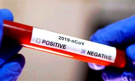 Dopo aver ottenuto un risultato positivo al test del coronavirus nella vostra farmacia amavita, potete utilizzare da subito la doctorchat di medi24. covid-negativo - Il Giornale di Caivano