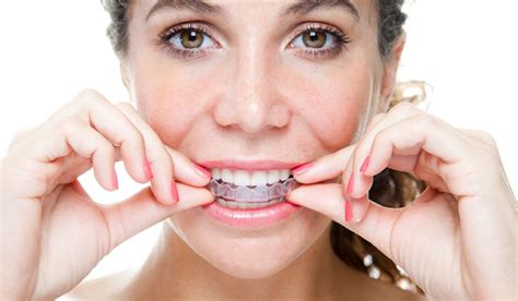 A retainer helps keep your teeth in place after braces. Perfect How Long Does It Take For Teeth To Shift After ...