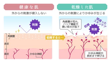 現代の髪型: 50+素晴らしい冬 乾燥 かゆみ クリーム おすすめ