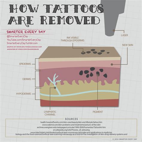 This method can be used to tailor. Laser tattoo works GIF on GIFER - by Braswyn