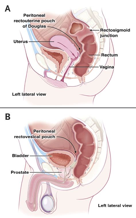 For the diagnosis of prostatic disorders, benign prostatic hyperplasia and the four types of prostatitis. Digital Rectal Examination and Anoscopy | NEJM