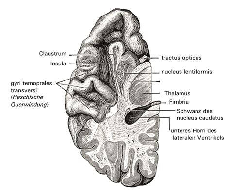 Das temporalhirn ist ein anatomischer teil des großhirns (telencephalon), der unterhalb und seitlich des frontallappens und des parietallappens liegt. File:Gyri temporales transversi.png - Wikimedia Commons