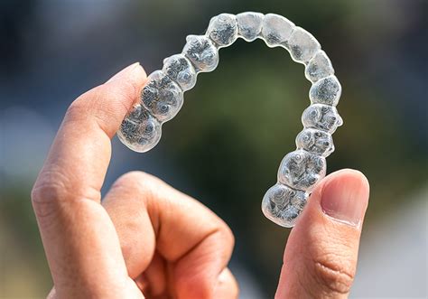 Gerade bei erwachsenen stören zahnlücken, schiefe zähne oder unharmonische zahnbögen den ästhetischen ausdruck des gesichtes. Invisalign oder Clear Aligner - Dr. med. dent. Kerstin Meudt