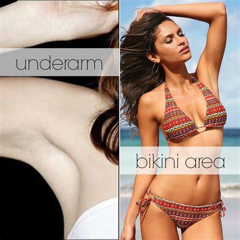 Hair removal creams for the bikini area are available over the counter without prescription, and contain chemicals like sodium or calcium hydroxide, titanium dioxide, barium sulfide and calcium thioglycolate which help in breaking down the protein structure present in hair. #WouldYouRather have laser hair removal on your underarm ...