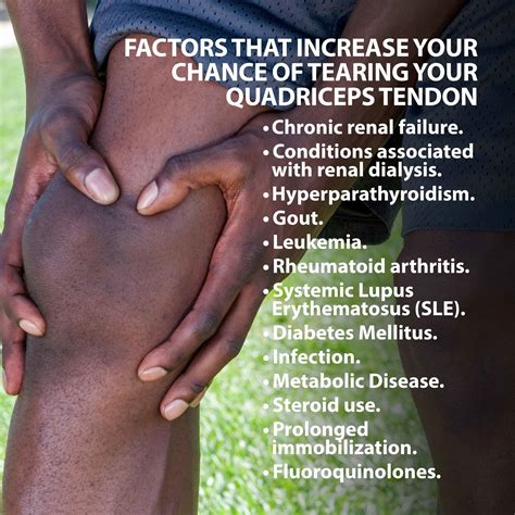 The quadriceps femoris muscle ( also called the quadriceps extensor, quadriceps or quads) is a large muscle group that includes the four prevailing muscles on the front of the thigh. Quadriceps Tendon Tear | Florida Orthopaedic Institute