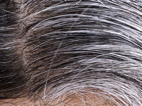 This may lead to overnight graying because previously present gray or white hairs suddenly become more obvious. Does pubic hair turn gray > ALQURUMRESORT.COM