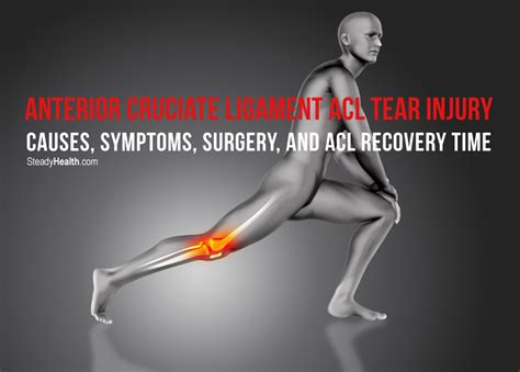 The prognosis of a partial acl the anterior cruciate ligament is composed of densely organized fibrous collagenous connective. Anterior Cruciate Ligament ACL Tear Injury: Causes ...