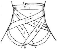 Колосовидная повязка накладывается на плечевой сустав при патологии подмышечной впадины и плеча. Студопедия — Повязки на область живота и таза