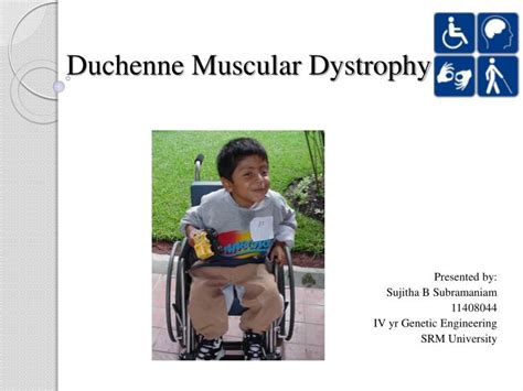 This can result in trouble standing up. PPT - Duchenne Muscular Dystrophy PowerPoint Presentation ...