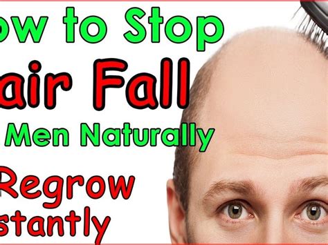 Should you notice a receding hairline or thinning hair at the crown of your head, the first thing to remember is that you're far from alone. How To Prevent Hair Loss For Teenage Guys | Regrow hair ...