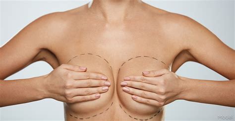Depending on your insurance company, a breast lift procedure might not be covered at all, period. Guide to Breast Lift Surgery | ABCS