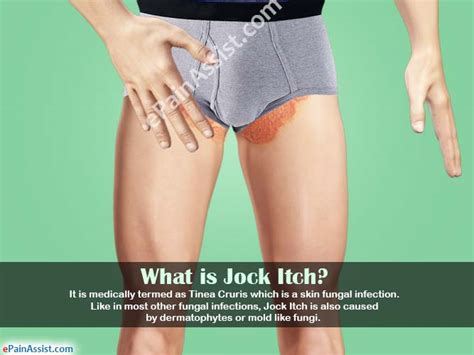 It last for 3 weeks,by the 2nd week she will bleed and by 3rd week she will want to be with a male, its called flagging, she will lift her tail and move it to the mosquito bites last so long for a few reasons. Jock Itch: Causes, Symptoms, Treatment, Home Remedies|Is ...