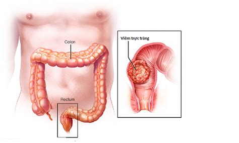 Tham vấn quy định về hoạt động kinh doanh. Trực tràng là gì, nằm ở đâu? Cấu tạo và chức năng