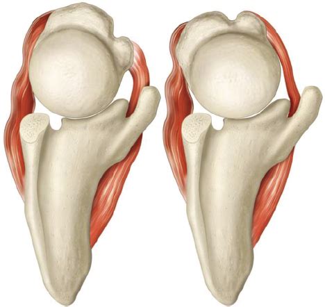 Let us look at wiring faults in an car. Shoulder with posterior glenoid wear in neutral (left) and external... | Download Scientific Diagram