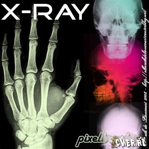 › x ray photo effect. how to xray on photoshop
