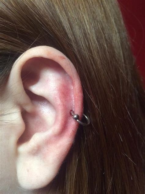 Show 10 more helix piercings Simple helix piercing with a BCR by Poh | Nd yag laser ...