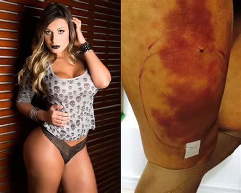 Andressa urach desmente boatos e nega participação em a fazenda. Após nova cirurgia, Andressa Urach permanece internada em ...