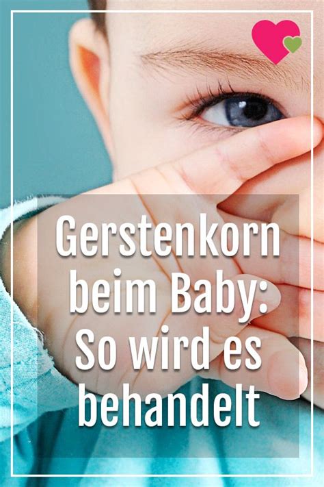 Du hast einen unschönen pickel am auge? Gerstenkorn am Auge: Behandlung beim Baby | Gerstenkorn ...
