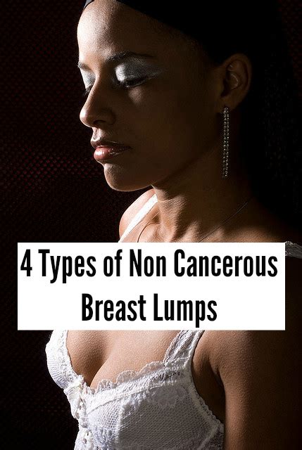 Depending on hormonal changes, a woman can have multiple simple cysts at once. Breast Health: Non-Cancerous Breast Lumps