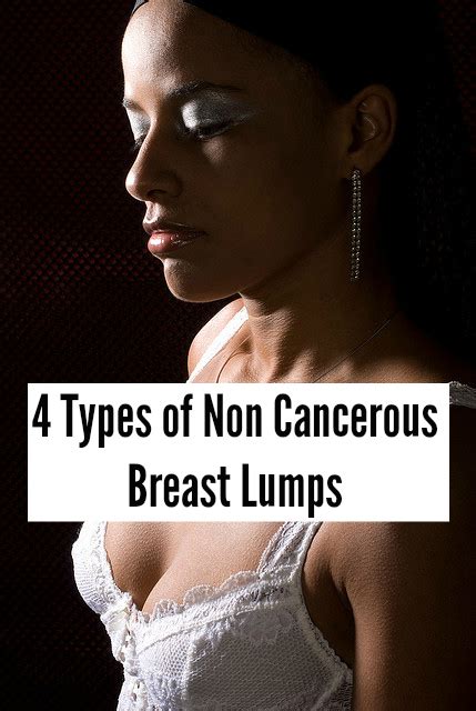 A cancerous breast lump will usually be hard and immobile when you push on it. Breast Health: Non-Cancerous Breast Lumps