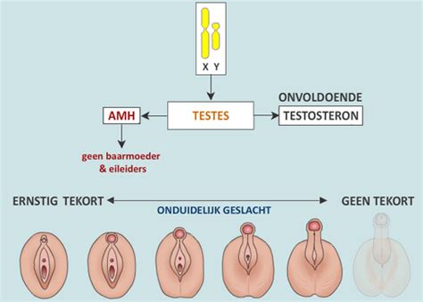 Check spelling or type a new query. 46,XY-DSD door een tekort aan testosteron - Medische ...