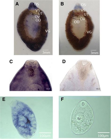 Maybe you would like to learn more about one of these? Diagram Of Liver Fluke - Diagram Of Liver Fluke Liver ...