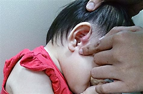 Preauricular pits are also known as preauricular cysts, fissures, or sinuses. Find Out Why Some People Have a Tiny Extra Hole in Their Ear