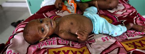 Without access to basic infrastructure, many people in papua new guinea do not have access to clean food or water. Unicef in Papua New Guinea: Malnutrition Prevention