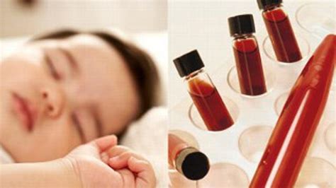 Sehingga anemia pada balita sukar untuk dideteksi. Cara Mengatasi Anemia Pada Anak - Dunia Herbal
