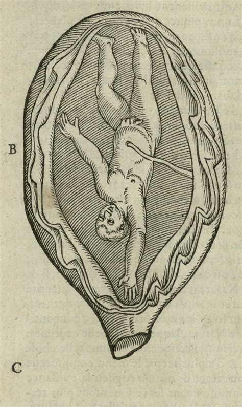 Would you share pictures on facebook of you and your partner together? Anxieties Surrounding Intersex Bodies in 16th Century Medicine