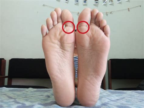 Rasa nyeri biasanya akan dirasakan saat bangun dari tidur pada pagi hari dan telapak kaki akan terasa sakit saat digunakan bertumpu ketika berjalan. 7 Titik Pijat Refleksi Kaki yang Bisa Dicoba Sendiri ...