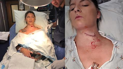 1910 s stewart ave ste b. Woman survives freak lawn mower accident that left her ...