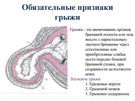 Грыжа передней брюшной стенки карта вызова