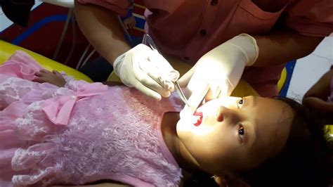 Gigi taring at indonesian => english of explained: CABUT GIGI TARING TIDAK SAKIT 🏥 Dokter Gigi 💖 Dental Care ...