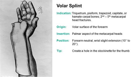 Thumb, first metacarpal, and carpal bones. SplintER Series: Common ED Splint Techniques | Splint ...