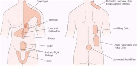 Pain under ribs on human body youtube. Pain in the Lower Right Side: Causes, Symptoms & Treatment