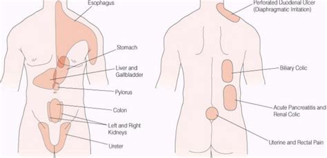 These are the organs that can directly give an abdominal pain if any one of them has a disorder. Pain in the Lower Right Side: Causes, Symptoms & Treatment