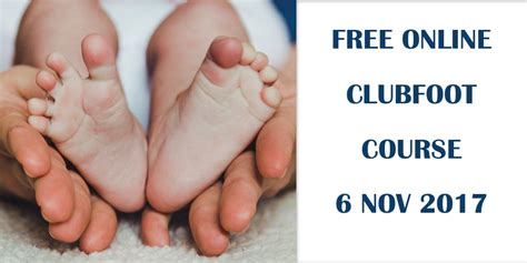 I created this site so others could learn about the ponseti method. Free Online Course for World Clubfoot Day! - Physiospot ...