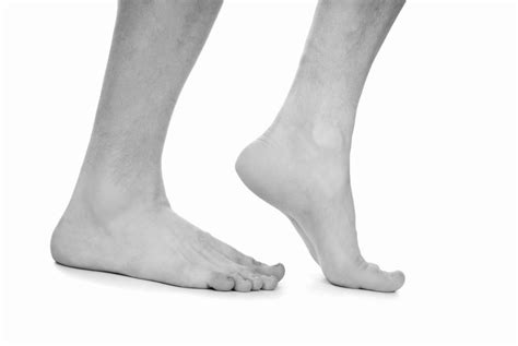 It occurred more frequently in american football players after artificial turf became more common on playing fields. What is a Turf Toe? Treatment for Turf Toe Orthopedic ...