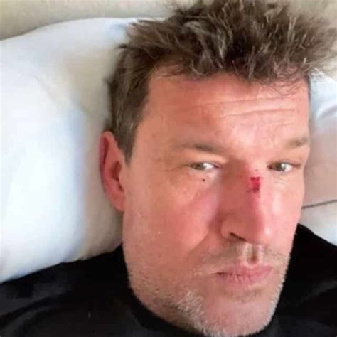 L'animateur de téléréalité benjamin castaldi en compétition aux jumping de longines masters. Benjamin Castaldi (TPMP) blessé violemment au visage « C ...