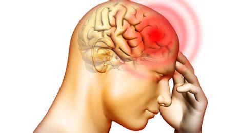 Rawatan dan cara mengatasi migrain. Bila Sakit Kepala Sebelah Kanan ! - ERAZ FADLI