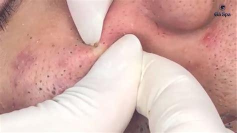 We apologize for any inconvenience. New blackhead removal videos 2019 > NISHIOHMIYA-GOLF.COM