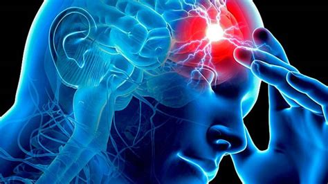 L'emorragia cerebrale è una perdita di sangue all'interno del cervello, con versamento ematico nei tessuti che lo compongono. Emorragia cerebrale: cos'è il male che ha ucciso Fabrizio ...