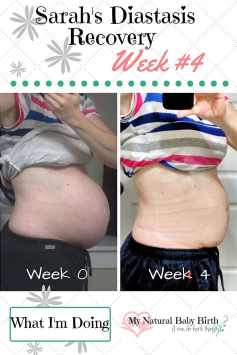 Why do i still look pregnant? How To Fix Diastasis Recti So You Look Like You've Never ...