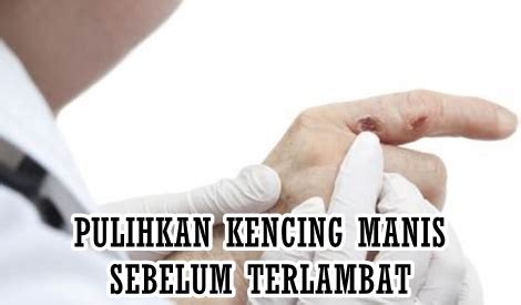 Buku ini berisikan tentang panduan dalam melakukan pemantauan kencing manis. PULIHKAN KENCING MANIS DENGAN BERKESAN SEBELUM TERLAMBAT ...