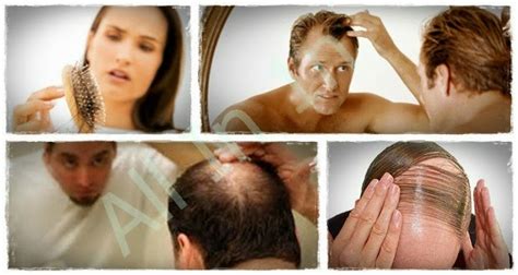 Can coconut oil cure baldness a hair transplant is the most intrusive and also costly treatment for hair loss. How to Thicken And Regrow Your Hair Naturally | Coconut ...