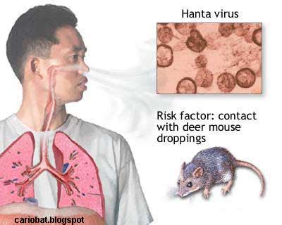 Tunggal yang mempunyai selubung (envelope) dengan persentase infeksi hantavirus pada suatu. Infeksi Hantavirus : Penyakit Virus Karena Tikus - Terapi ...