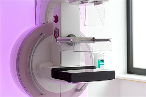 Diese untersuchungsmethode hat eine hohe sensitivität. MAMMOGRAPHIE - Radiologisches Zentrum Wangen