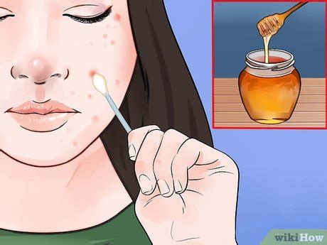 But it also can be used for those occasional chin hairs that pop up out of nowhere. 4 Formas de Tirar um Pelo Encravado do Rosto - wikiHow